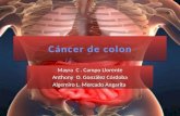 Cancer de colon QX