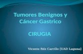 Tumores benignos de Estomago y Cáncer gástrico
