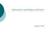 Valoración radiológica del tórax