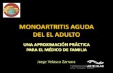 Monoatritis aguda del adulto