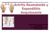 Artritis Reumatoidea Y Espondilitis Anquilosante