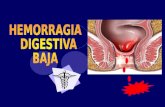 Hemorragia digestiva baja expo