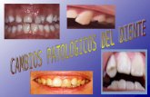 os patologicos del diente