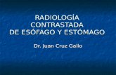 RadiologÍa Contrast Ada