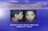 Hipertiroidismo en Pediatria