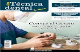 alta tecnica dental - conoce el secreto para obtener el exito en protesis fija