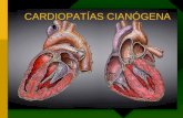 Cardiopatía congénitas cianogenas