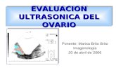 Ultrasonido Del Ovario