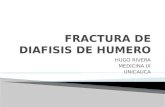 Fx Diafiasiaria de Humero y Lux. Hombro