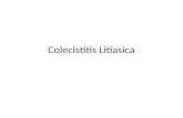 Colecistitis Litiasica