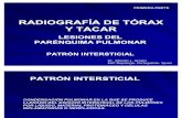 RADIOGRAFÍA DE TÓRAX Y TACAR. PATRÓN INTERSTICIAL. PARTE 1