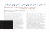 Bradicardia Nursing