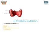 HIPOPARATIROIDISMO caso clinico