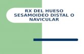 Rx Del Hueso Sesamoideo Distal o Navicular[1]