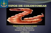 Tipos de Colostomias
