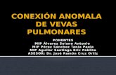 CONEXIÓN ANOMALA DE VENAS PULMONARES (CAVP)