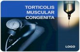 Torticolis Muscular Congenita