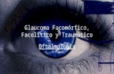 Glaucoma Facomórfico, Facolítico y Traumático