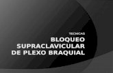 Bloqueo Supraclavicular de Plexo Braquial