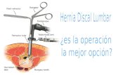 Hernia Discal, ¿es la operación la mejor opción?
