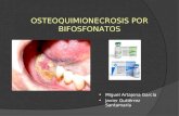 Osteoquimionecrosis por bifosfonatos