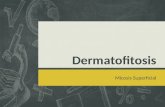 Dermatofitosis - Hongos