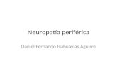 Neuropatía periférica