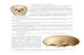Osteología de cráneo