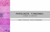 Patología tiroidea: casos clínicos