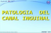 3.  Patología de Canal Inguinal Pediatría