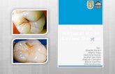 Historia Natural de la Caries Dental