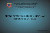 Frenilectomia Labial y Lingual. Reporte de un Caso