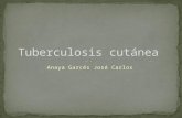 Tuberculosis cutanea 2