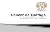 Cancer De Esofago   Final