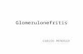 Glomerulonefritis aguda post estreptococcica