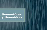 Neumotórax y Hemotórax