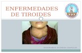 Enfermedades de tiroides Med 2 (UPAO), Gianmarco Guzman Castillo