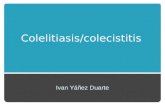 Colelitiasis - Colecistitis