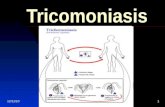 Mapa de tricomoniasis 5 año