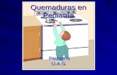 Quemaduras En Pediatr­A