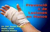 Preventing hand injuries 2