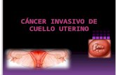 Cancer invasivo de cuello uterino