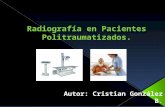 Radiograf­a en pacientes politraumatizados