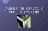 Cáncer de cérvix o cuello uterino