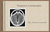 191 - Tumores cerebrales