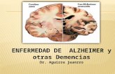 Demencias y alzheimer presentacion