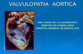 Valvulopatia  aortica