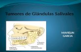 Seminario tumores de glandula salivar
