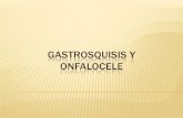 Onfalocele gastrosquisis-hernias