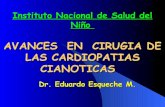 Avances quirúrgicos en cardiopatías cianóticas